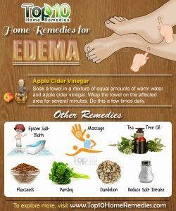 A list of home remedies for edema, including apple cider vinegar, epsom salt baths, massages, tea tree oil, flax seeds, parsley, dandelion, and reducing salt intake.