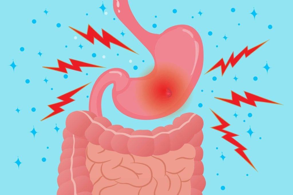 A cartoon stomach with a red, inflamed area and several red lightning bolts around it.