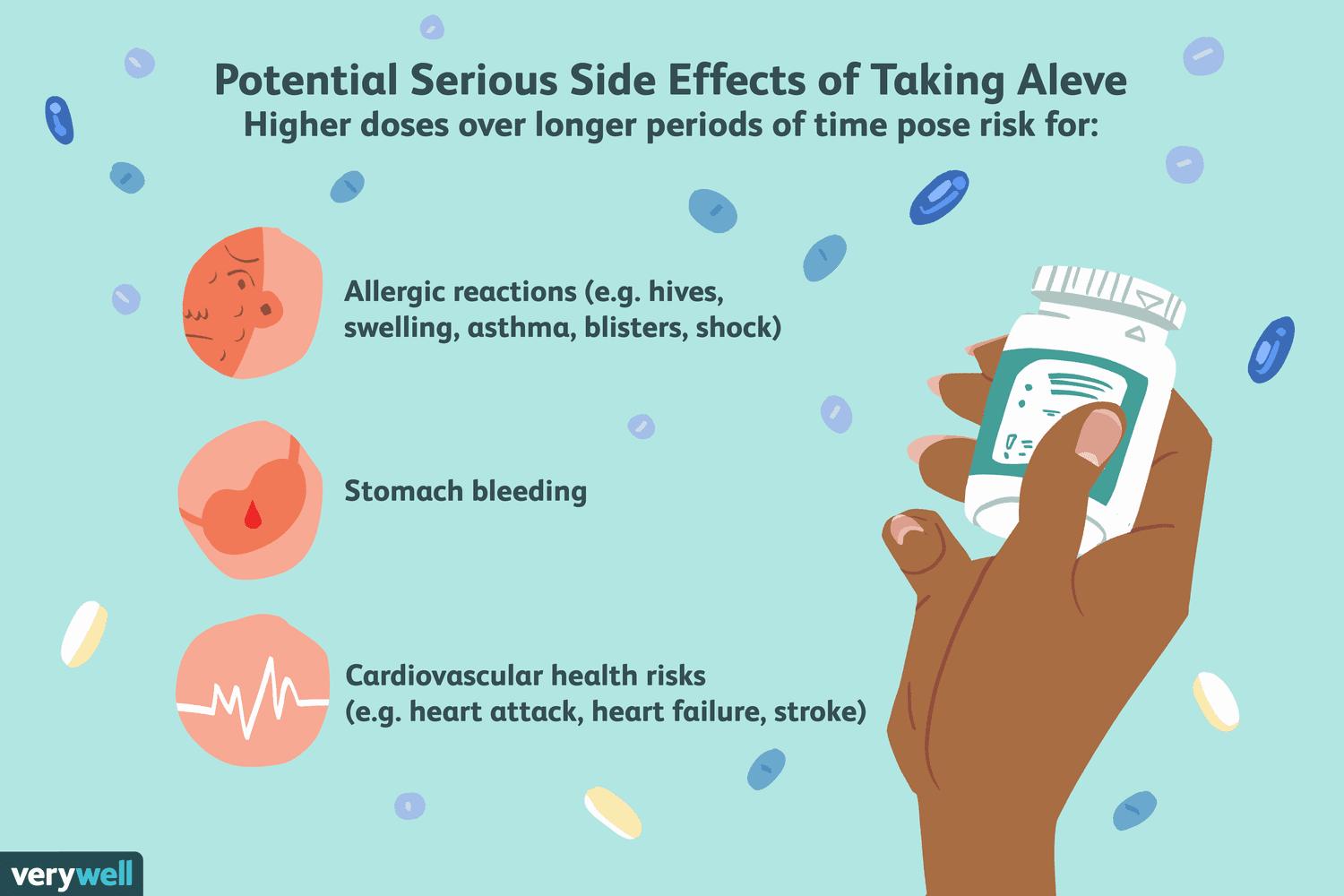 Potential serious side effects of taking Aleve include allergic reactions, stomach bleeding, and cardiovascular health risks.