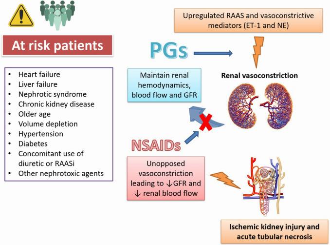 A diagram showing the relationship between NSAIDs and acute kidney injury.