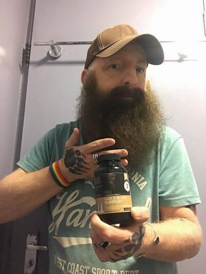 A bearded man wearing a brown cap and green shirt holds up a bottle of hair and beard vitamins.