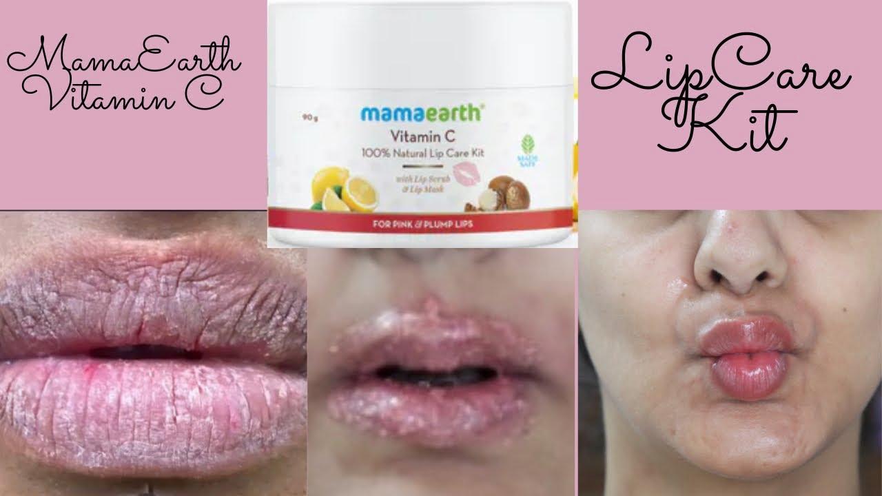 This image shows a before-and-after comparison of lips using Mama Earths Vitamin C lip care kit.
