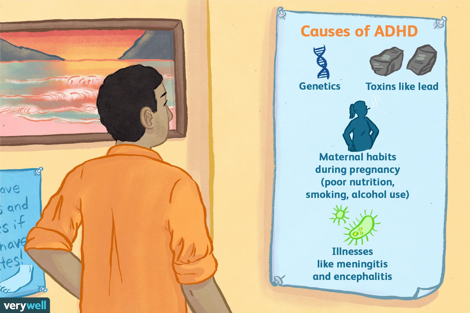 An illustration showing a man standing next to a poster that lists the causes of ADHD.