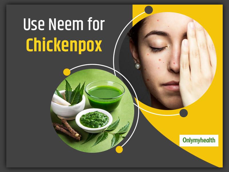A woman with chickenpox covering her face with her hand while neem leaves and paste sit beside her.