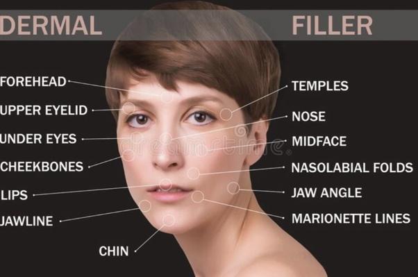 Botox at 50 Before and After: Transformative Effects