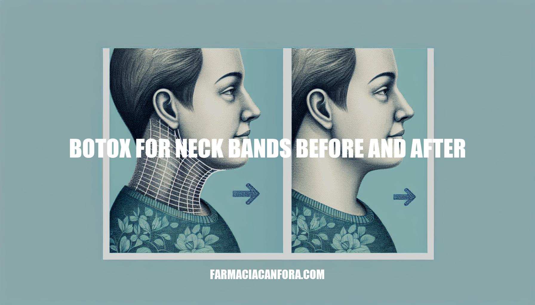 Botox for Neck Bands Before and After