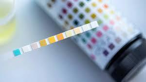A urine test strip with different colored squares on it.
