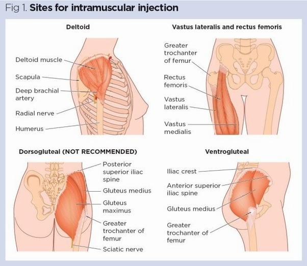 A diagram showing the deltoid, vastus lateralis, rectus femoris, dorsogluteal, and ventrogluteal injection sites.
