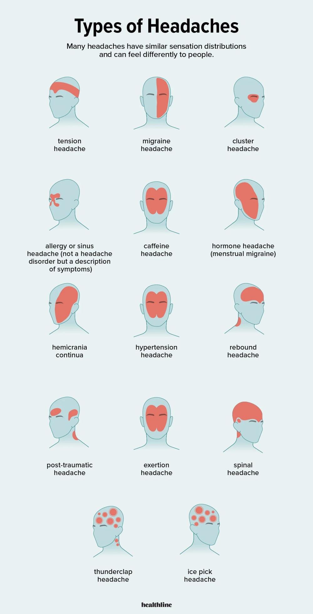 A chart of 16 different types of headaches and where on the head they are felt.