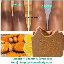 Before and after using turmeric and vitamin C soap for two and a half weeks.