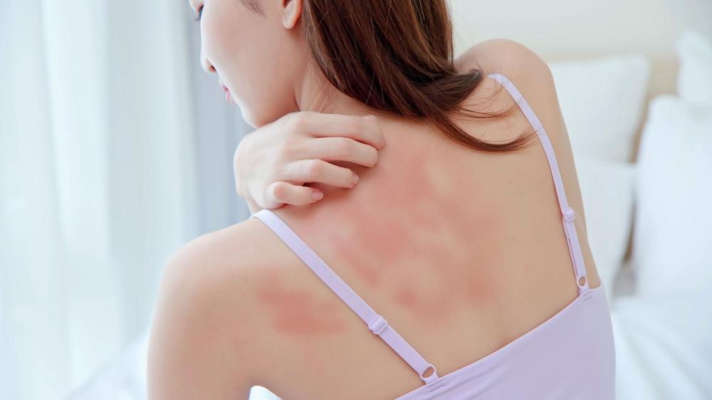 A woman with long dark hair wearing a pink sports bra is scratching her back which is sunburnt.