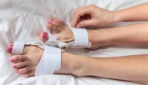 A person with bunions on their feet is wearing a bunion corrector.