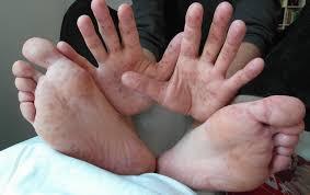 An image of a persons hands and feet.