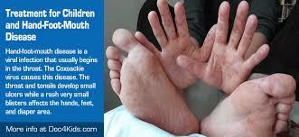 A person with hand, foot and mouth disease with blisters on their hands and feet.