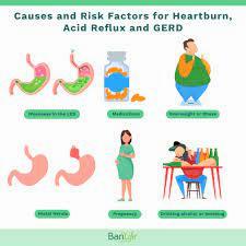 A diagram showing causes and risk factors for heartburn, acid reflux and GERD, including overeating, obesity, pregnancy, hiatal hernia, and certain medications.