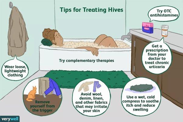 A woman taking a bath to relieve the itchiness of hives, with tips for treating hives.