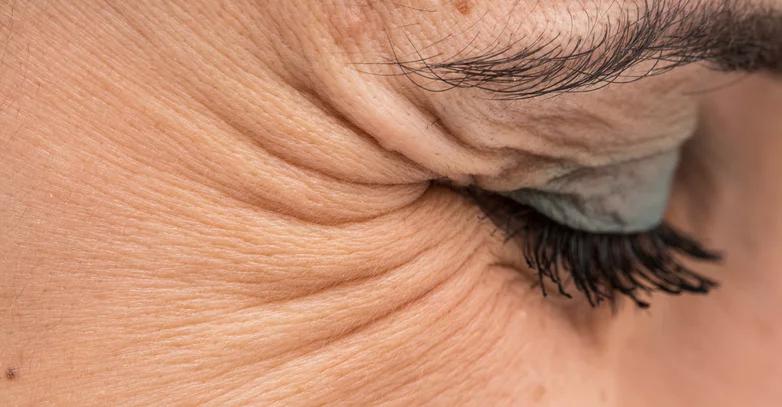 The image shows a close-up of a womans eye with crows feet wrinkles.