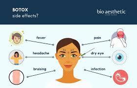 Possible side effects of Botox include bruising, headache, fever, pain, dry eye, and infection.
