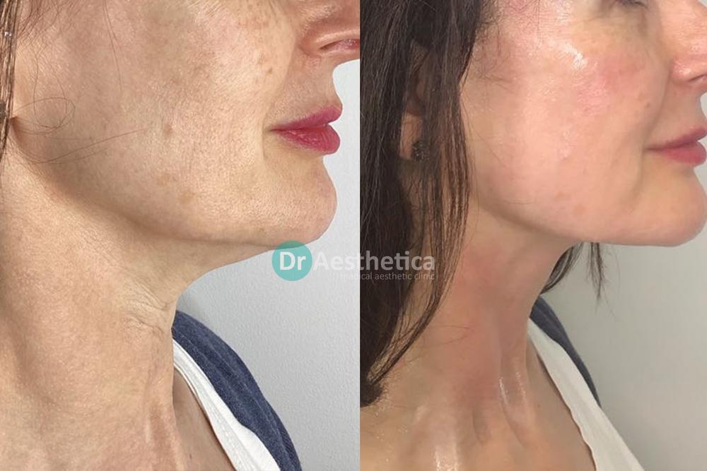 The image shows a womans face before and after a cosmetic procedure, with text indicating it was performed by Dr. Aesthetica.