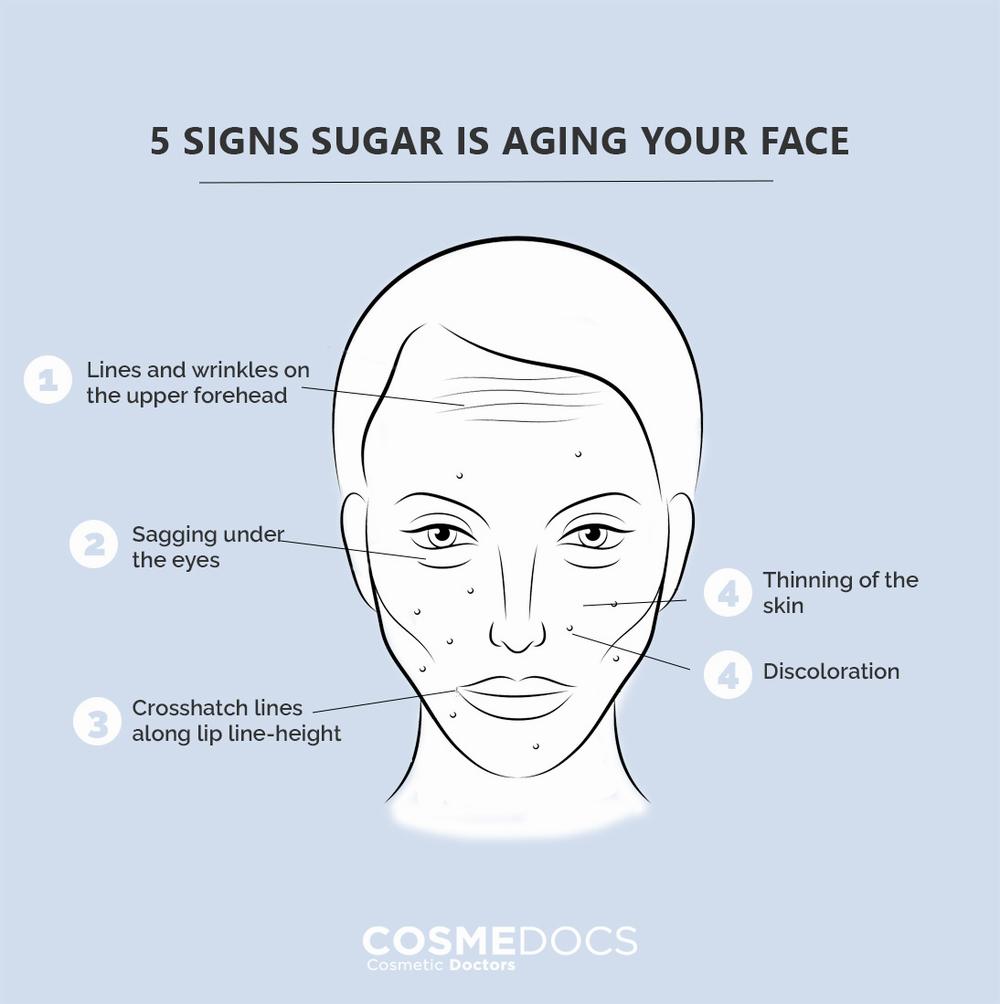A diagram showing the five signs of sugar-aging on the face: lines and wrinkles on the forehead, sagging under the eyes, crosshatch lines along the lip line, thinning skin, and discoloration.