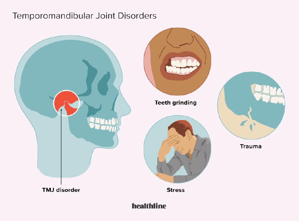 This diagram shows the causes of temporomandibular joint disorders (TMJ), which include teeth grinding, trauma, and stress.