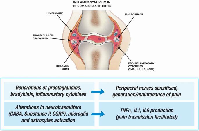 Inflammatory mediators and pain generation in rheumatoid arthritis.