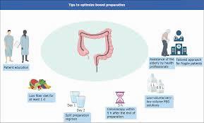 A diagram showing the steps of bowel preparation for a colonoscopy, including patient education, a low fiber diet, split dose preparation, and low volume PEG solution.