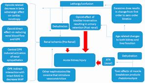 A flowchart showing the pathophysiology of acute kidney injury.