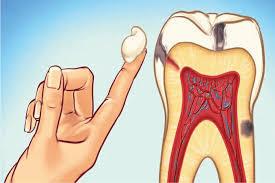 An illustration showing a finger pulsing with a tooth in the background.
