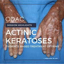 A persons hands with Actinic Keratosis.
