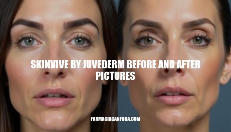 Juvederm Skinvive Before and After Photos: Visual Evidence for Effective Treatment