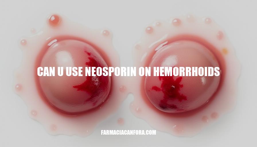 Can You Use Neosporin on Hemorrhoids? Treatment and Relief Options